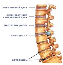 позвоночник